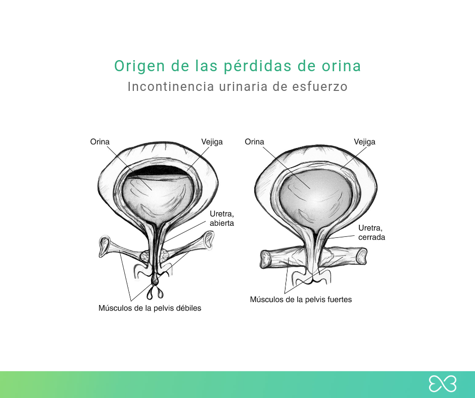 perdida orina mujer